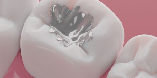 Filing’s-Silver-&-Cosmetic