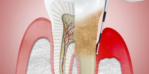 Tt-of-Oral-&-Gum-Diseases