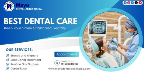 Best Dental Implants in Noida Sector 150 | Maya Dental Clinic